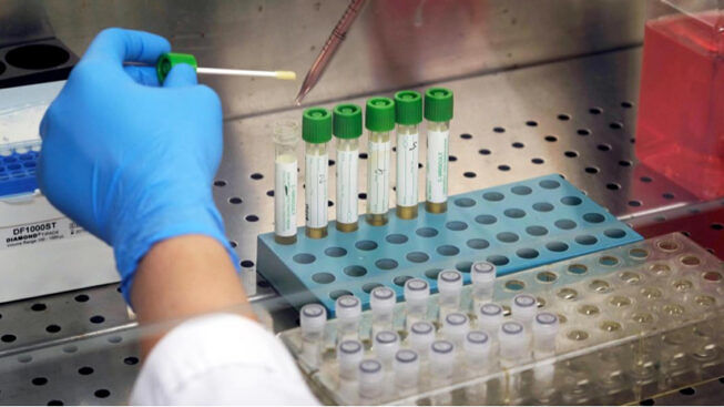 Coronavirus, accordo screening sierologici: 61 laboratori per test a 400mila persone