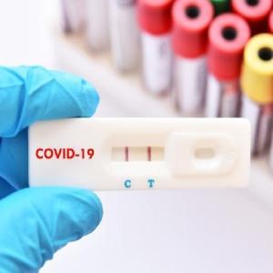 Emergenza Covid, tamponi rapidi gratuiti in farmacia per studenti e loro familiari