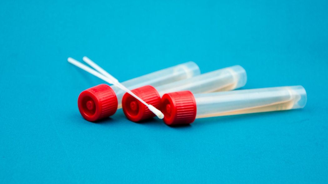 Coronavirus, migliorano condizioni dei ricoverati. Due nuovi casi in attesa di validazione