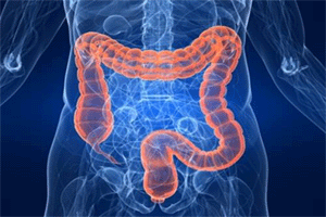 Tumore al colon retto, campagna straordinaria di screening in corso 