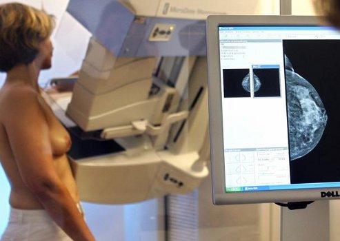 Screening oncologici, ripresa l'attività sospesa a metà marzo per l'emergenza Covid-19